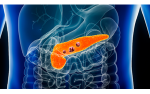 آزمایش خون جدیدی که می‌تواند جان هزاران نفر را از سرطان پانکراس نجات دهد