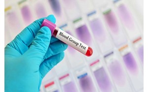 کدام گروه‌ خونی بیشتر از همه سکته مغزی می‌کند؟