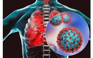چرا واکسن RSV در دوران بارداری توصیه می‌شود؟