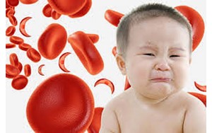 علامت های پنهان کم‌خونی در کودکان که والدین هرگز نباید نادیده بگیرند