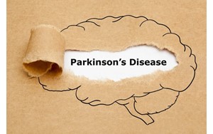 یک عامل تشدیدکننده خطر پارکینسون