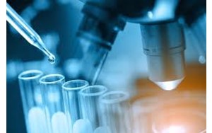 کشف عامل جدید گسترش سرطان تخمدان