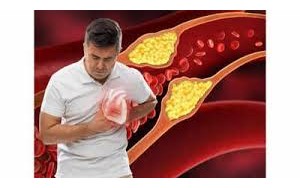 سندرم CKM که تا به حال درباره‌اش نشنیده‌اید